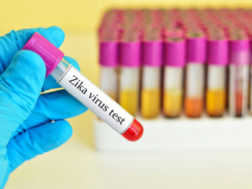 zika-virus-can-live-in-your-sa